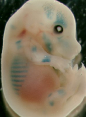 Mice embryo_LacZ staining